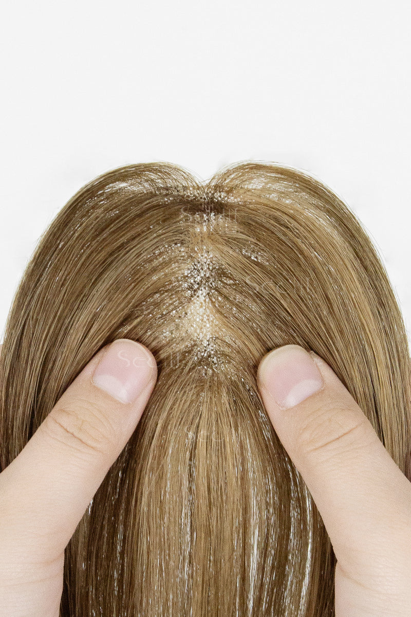 Close-up of a hairline with visible thinning and scalp condition, held by two fingers against a white background.