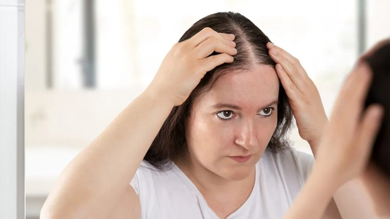 hair loss