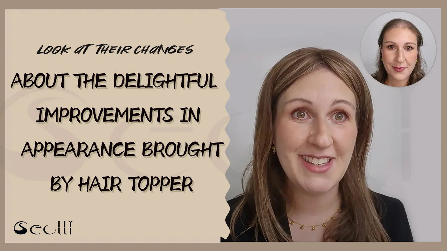 ABOUT THE DELIGHTFUL IMPROVEMENTS IN APPEARANCE BROUGHT BY HAIR TOPPER