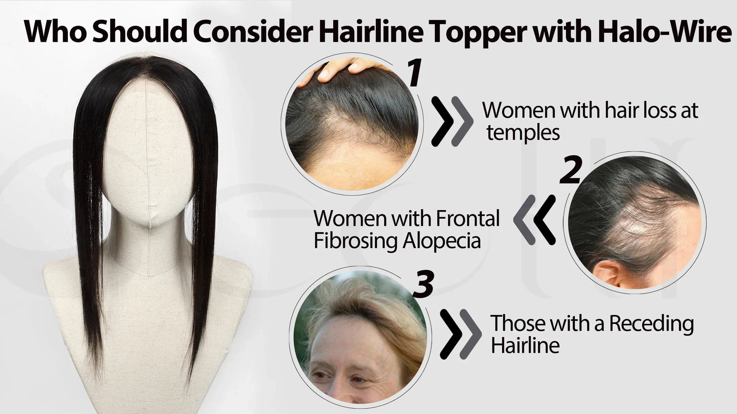 Say Goodbye to Hairline Worries: Aurora Hairline Topper Grows "Natural New Hair" at Your Forehead